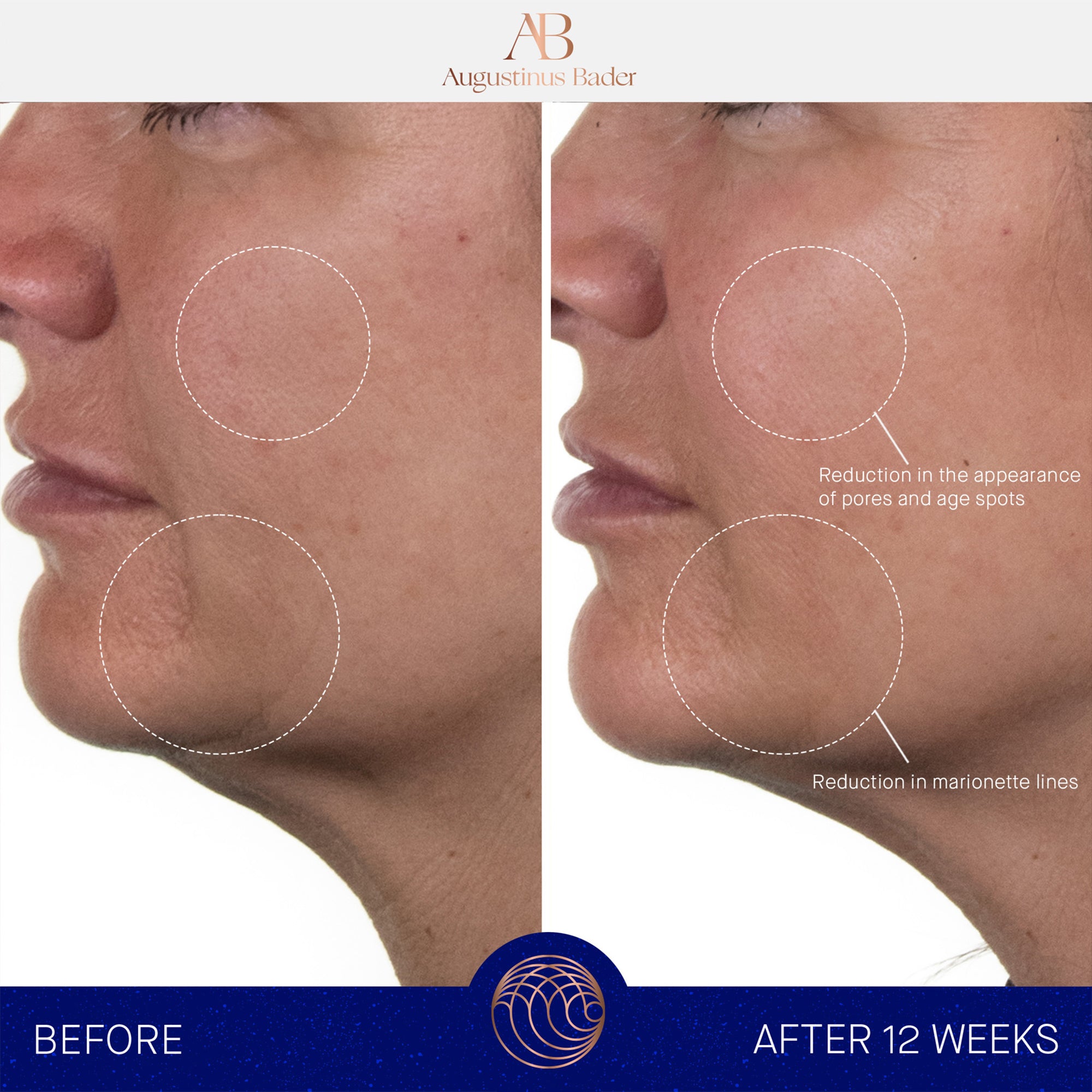 Augustinus Bader The Rich Cream | Metro DC Area Skincare Boutique