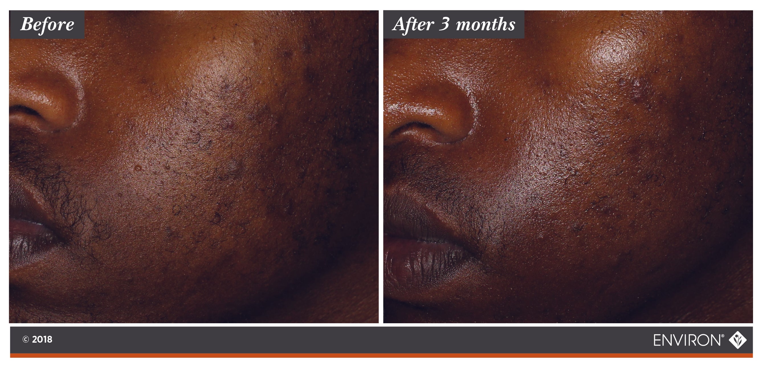 Botanical Infused Sebu-Tone Clarifier