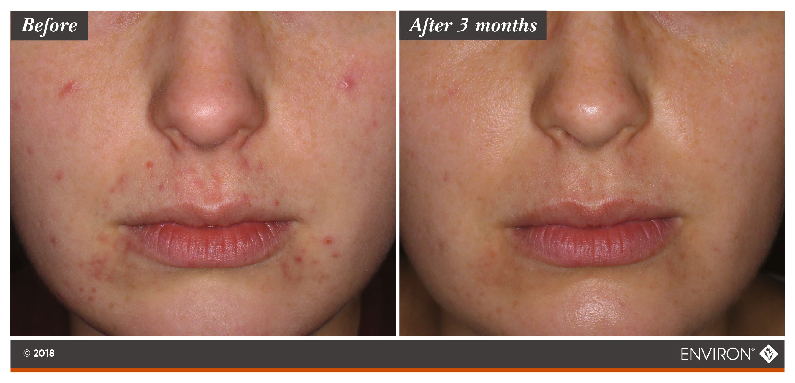 Environ Botanical Infused Sebu-Wash Gel Cleanser | Metro DC Area Skincare Boutique