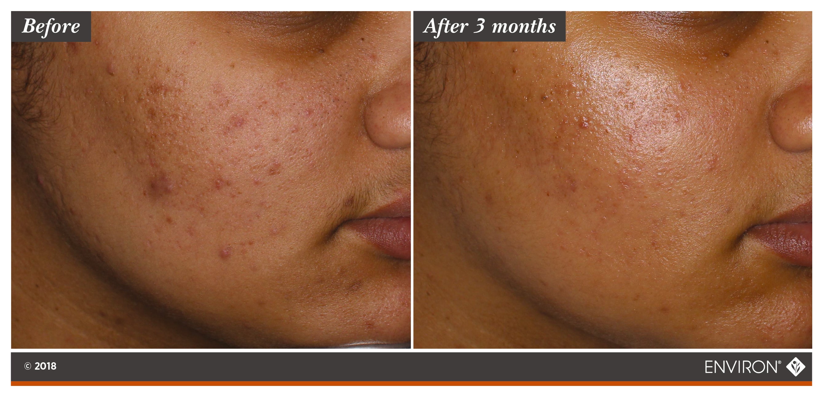 Environ Botanical Infused Sebu-Wash Gel Cleanser | Metro DC Area Skincare Boutique