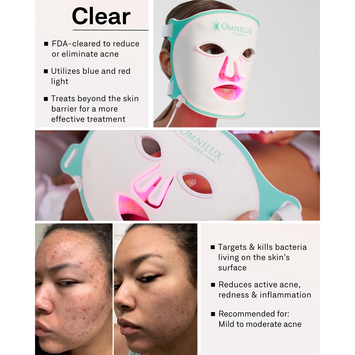 Omnilux Clear LED mask for acne treatment | Metro DC Area Skincare Boutique