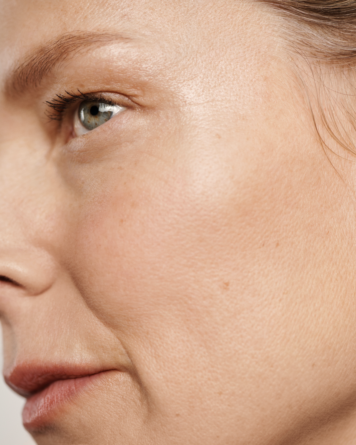 How Do You Get Rid of Blackheads?