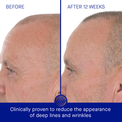 Augustinus Bader Retinol Serum | Metro DC Area Skincare Boutique