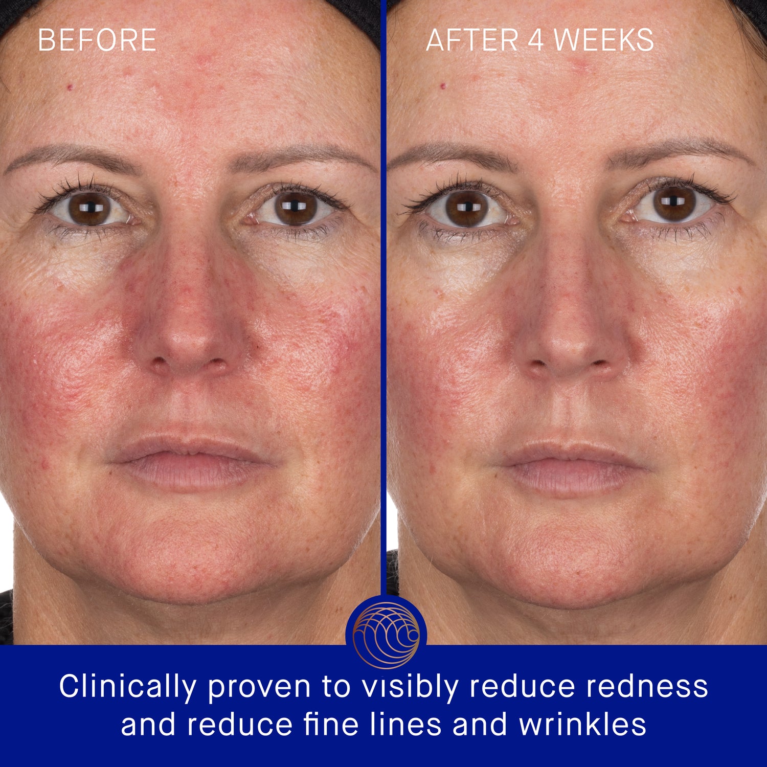 The Hydrogel Face Mask (6 Sachet)