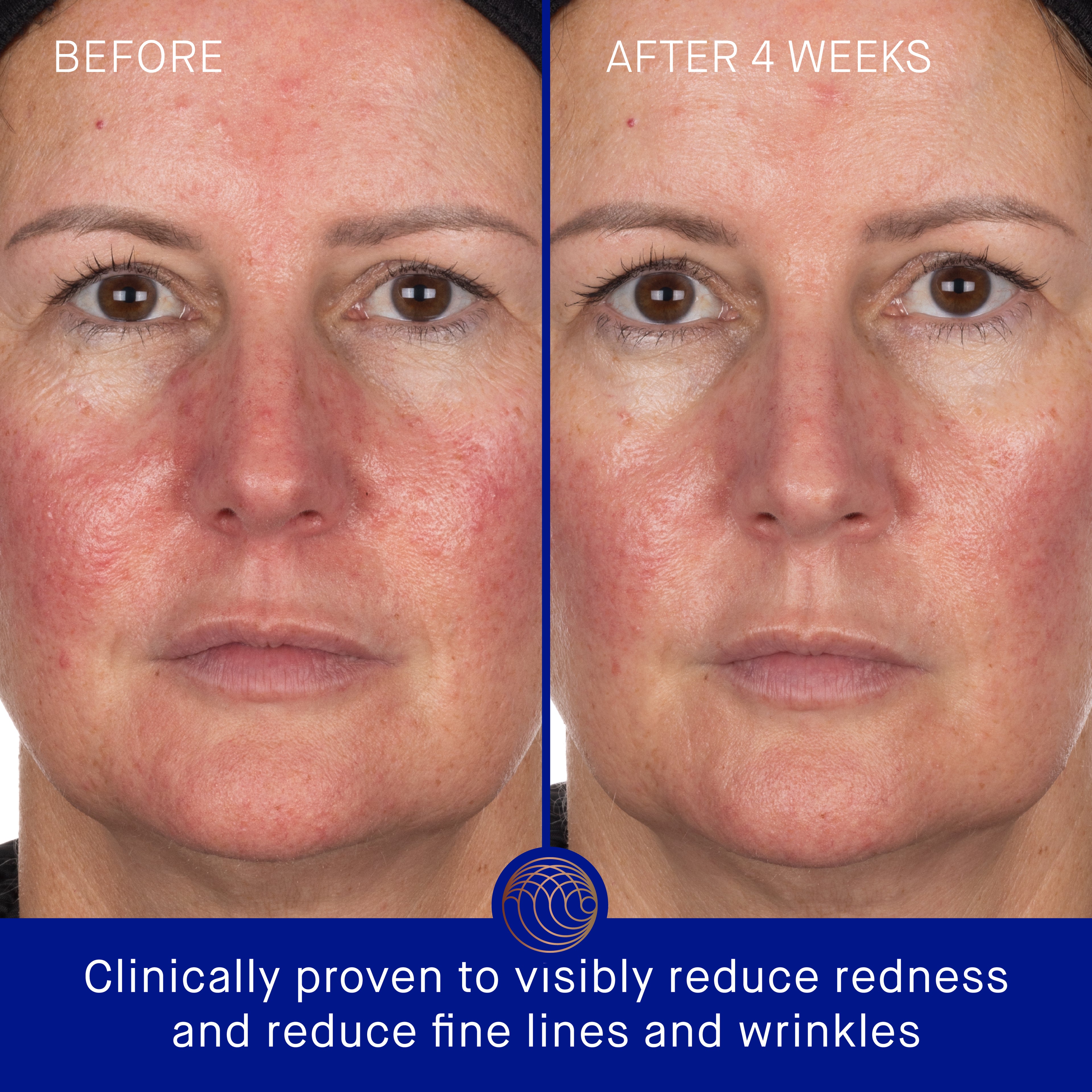 The Hydrogel Face Mask (6 Sachet)